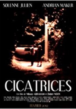 Cicatrices